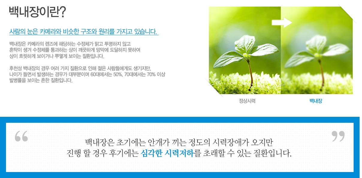 鳻 ī޶  شϴ ü   ʰ 
ȥŹ  ü ϴ  ϰ   Ͽ 
 帴ϰ ̰ų ѿ ̴ ȯԴϴ.

õ 鳻    ȯ   鿡Ե , 
̰ 鼭 ߻ϴ 찡 κ̸ 60뿡 50%, 70뿡 70% ̻ 
ߺ ̴  ȯԴϴ. 鳻 ʱ⿡ Ȱ   ÷ְ  
   ı⿡ ɰ ÷ϸ ʷ  ִ ȯԴϴ. 
