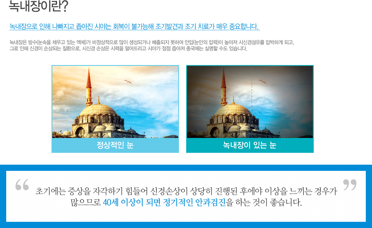 쳻 ( ä ִ ü)   ǰų  Ͽ Ⱦ( з)  ýŰ漶 йϰ ǰ,
׷  Ű ջǴ ȯ, ýŰ ջ ÷ ߸ þ߰    Ǹ  ֽϴ. ʱ⿡  ڰϱ  Űջ   Ŀ ̻  찡
Ƿ 40 ̻ Ǹ  Ȱ ϴ  ϴ.