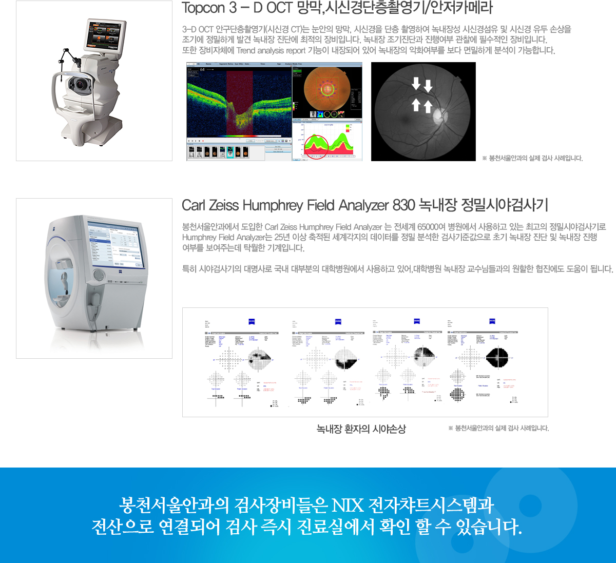 3-D OCT ȱԿ(ýŰ CT)  , ýŰ  ԿϿ 쳻强 ýŰ漶  ýŰ  ջ
⿡ ϰ ߰ 쳻 ܿ  Դϴ. 쳻 ܰ ࿩  ʼ Դϴ. 
 ü Trend analysis report  Ǿ ־ 쳻 ȭθ  ϰ м մϴ.  õȰ  Carl Zeiss Humphrey Field Analyzer   65000  ϰ ִ ְ нþ߰˻
Humphrey Field Analyzer 25 ̻  谢 ͸  м ˻ذ ʱ 쳻   쳻 
θ ִµ Ź Դϴ. 

Ư þ߰˻   κ к ϰ ־,к 쳻 Ե    ˴ϴ. õȰ ˻ NIX íƮý۰ 
 Ǿ ˻  ǿ Ȯ   ֽϴ. 